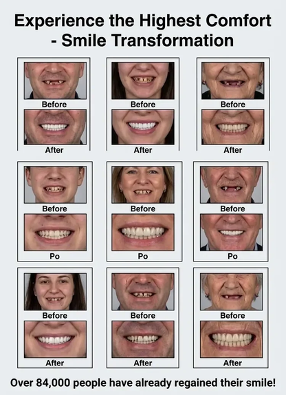 🎉Exclusive Offer Celebrating America's 250th Anniversary💥-KLENIMORE™ Custom-Fit Smile Support Kit